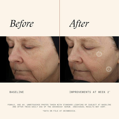 TNS Advaced + Serum