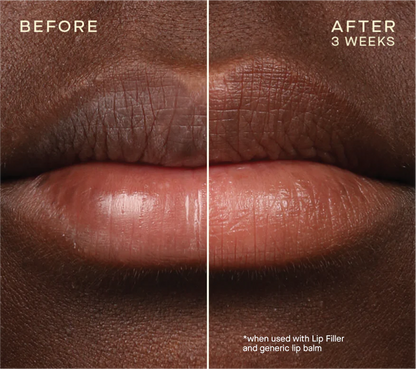 Ourself Lip Plumping No Needle